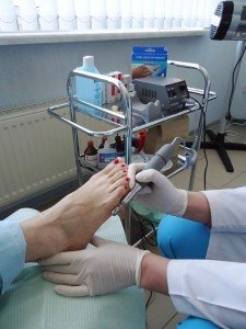 Процес видалення натоптишів та мозолів при апаратному педикюрі 