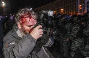 Фотограф Reuters Гліб Гараніч, який також постраждав під час кривавого нічного розгону Майдану 30 листопада