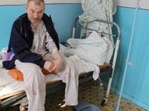 Фото: Полтавець позбувся ніг через обмороження